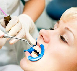 Icon Dental Sealants